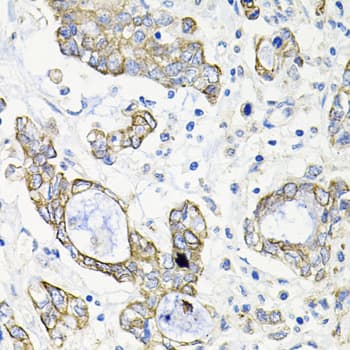 Polyclonal Rabbit anti-Human ACVR2 / ACVR2A Antibody (IHC, WB)