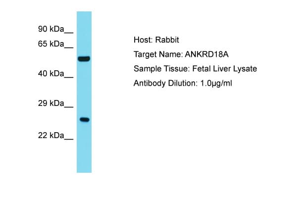 Polyclonal Rabbit anti-Human ANKRD18A Antibody (aa781-830, WB)