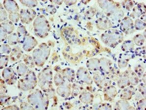 COPS4 / CSN4 Antibody (aa1-310)