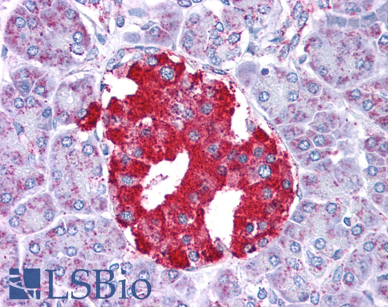 GLUD1/Glutamate Dehydrogenase Antibody (aa182-231)