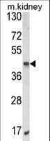 PCA1 / ALKBH3 Antibody (aa242-269)