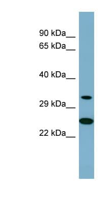 PRKAB2 / AMPK Beta 2 Antibody (aa179-228)