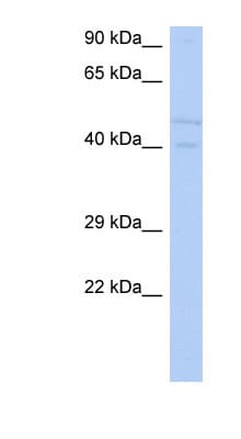 SGK3 Antibody (aa107-156)