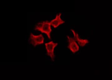 SREBF1 / SREBP-1 Antibody