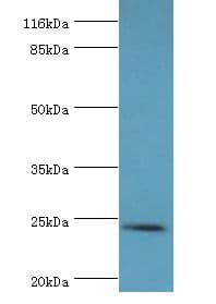 Amisyn / STXBP6 Antibody (HRP)