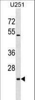 Polyclonal Rabbit anti-Human ULBP2 / RAET1H Antibody (aa88-116, WB)