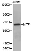 MITF Antibody