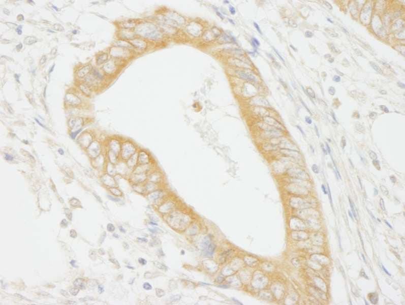 MAP4K4 Antibody (aa550-600)