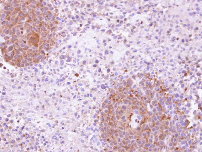 MAP4K5 Antibody (aa417-482)