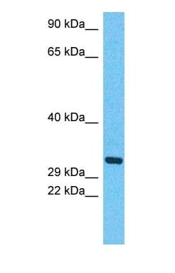 Polyclonal Rabbit anti-Human TPM1 / Tropomyosin Antibody (N-Terminus, WB)