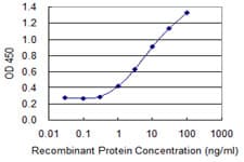 Monoclonal Mouse anti-Human BNC1 / Basonuclin Antibody (clone 1F4, WB)
