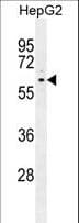 PPARD / PPAR Delta Antibody (aa367-394)