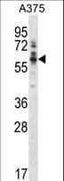 PTK6 / BRK Antibody (aa1-28)