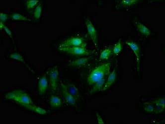 Polyclonal Rabbit anti-Human SSX2IP Antibody (IHC, IF, WB)