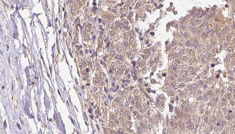 NCF1 / p47phox / p47 phox Antibody
