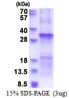 Human TGFBRAP1 / TRAP-1 Protein (Recombinant His)