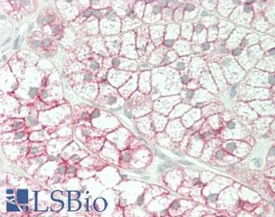 IHC-plus™ Cadherin Antibody (C-Terminus, clone PC-79)