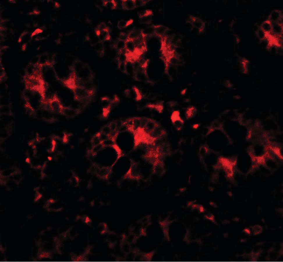 IHC-plus™ Polyclonal Rabbit anti-Human DAP Antibody (IHC, IF, WB)