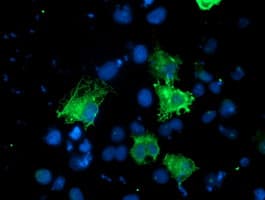 KCNAB1 Antibody (clone OTI2F1)