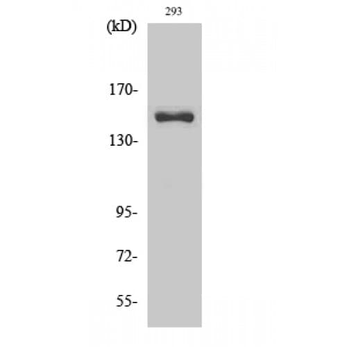COL4A3 / Tumstatin Antibody (1350-1430 aa, C-terminal)