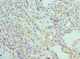IHC-plus™ Polyclonal Rabbit anti-Human PSMD5 Antibody (aa255-504, IHC)