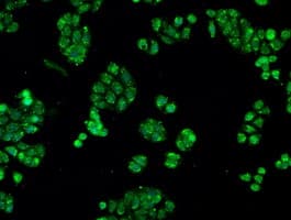 IHC-plus™ CRYAB / Alpha B Crystallin Antibody (clone 6D11)