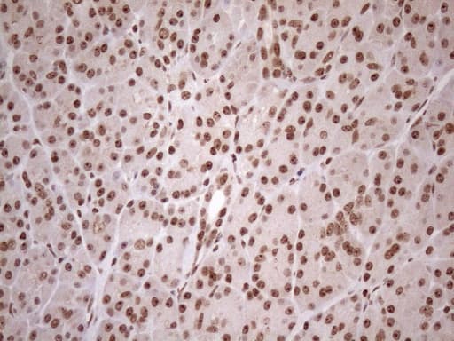 EXOSC1 / CSL4 Antibody (clone OTI4B7)