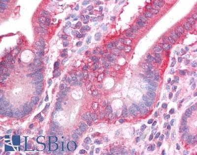 IHC-plus™ VISA / MAVS Antibody (aa1-65)