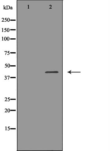 SSTR2 Antibody