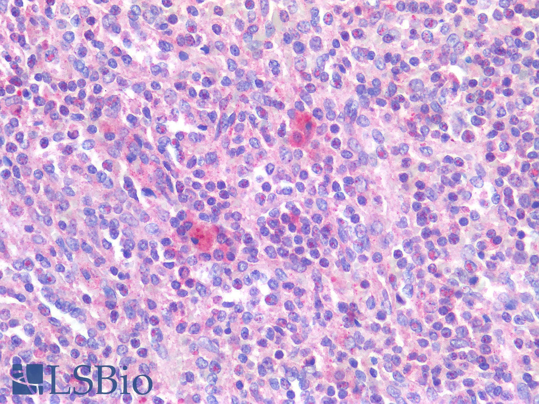 IHC-plus™ TNF Alpha Antibody