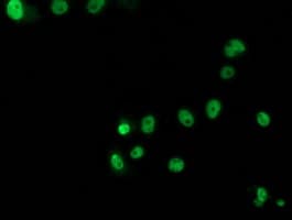 TP53 / p53 Antibody (clone OTI5D9)