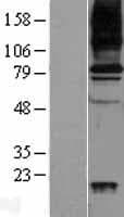 Human AOC3 / VAP-1 Protein (Over-Expression Lysate Myc-DDK (Flag))
