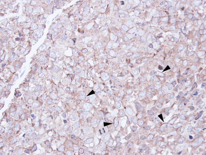 SCARA3 / APC7 Antibody (aa187-474)