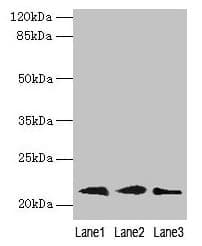Polyclonal Rabbit anti-Human RAP1B Antibody (IHC, WB)