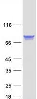 Human PPM1G Protein (Recombinant Myc-DDK (Flag))