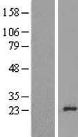 RPL24 / Ribosomal Protein L24 (Over-Expression Lysate Myc-DDK (Flag))