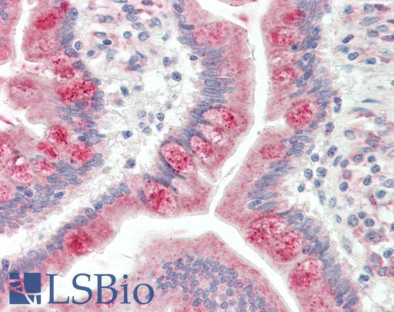 IHC-plus™ MC3R / MC3 Receptor Antibody (aa86-112)