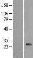 TMEM81 Protein (Over-Expression Lysate Myc-DDK (Flag))