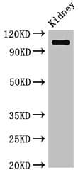 Polyclonal Rabbit anti-Human ANPEP / CD13 Antibody (IHC, IF, WB)