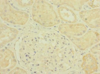 PLXNB2 / Plexin B2 Antibody