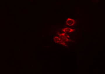 AKR1A1 Antibody