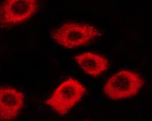Polyclonal Rabbit anti-Human c-Met Antibody (phospho-Tyr1003, IHC, IF, WB)