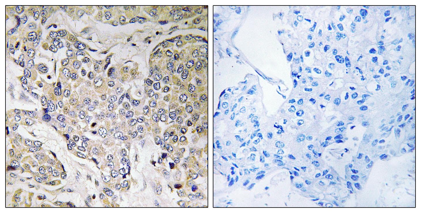 CEP41 / TSGA14 Antibody