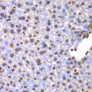 ULK4 Antibody