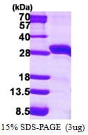 Human STAR Protein (Recombinant His)