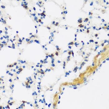 Polyclonal Rabbit anti-Human APOBEC3F / ARP8 Antibody (IHC)