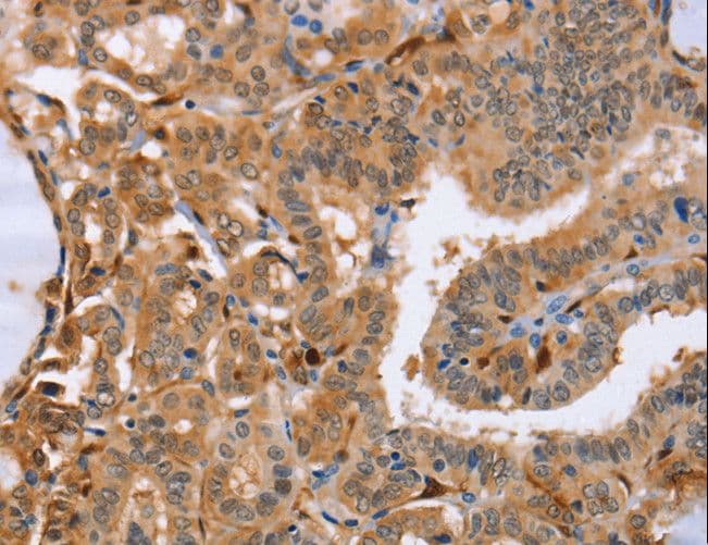 Latexin / MUM Antibody
