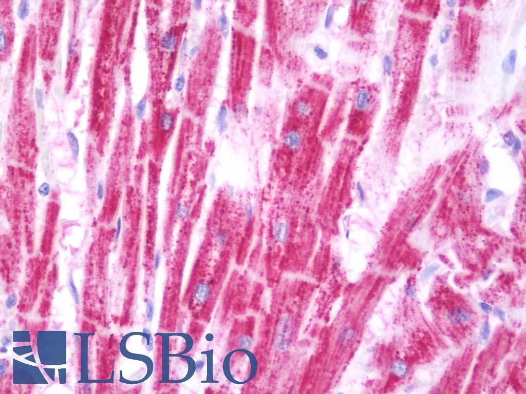 IHC-plus™ PDHA1 / PDH E1 Alpha Antibody (aa39-325)