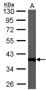 PPP1CC / PP1 Gamma Antibody (aa2-227)