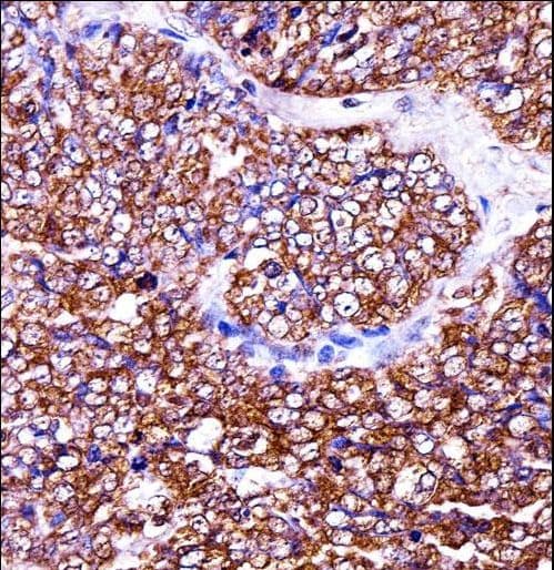 BAG2 Antibody (aa148-176)